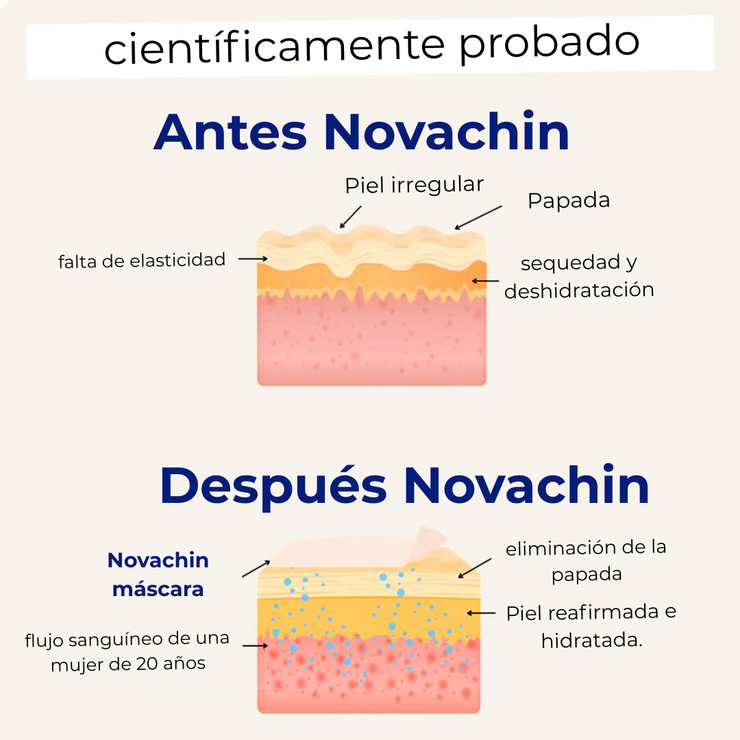 Levantamiento de papada: Nunca más me avergüenzo de mi papada